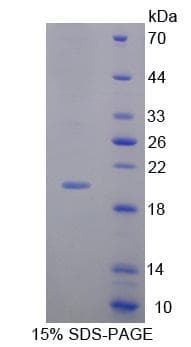 Rabbit MMP13 Protein (Recombinant His)