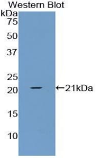 TIMP1 Antibody (aa24-207)