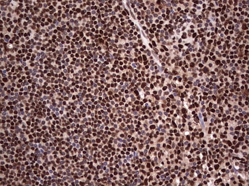 Monoclonal Mouse anti-Human SAE1 Antibody (clone OTI6B11, IHC, WB)