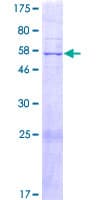 Human LMNTD1 / IFLTD1 Protein (Recombinant GST)
