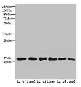IHC-plus™ Polyclonal Rabbit anti-Human SOD1 / Cu-Zn SOD Antibody (aa 2-154, IHC, IF, WB)