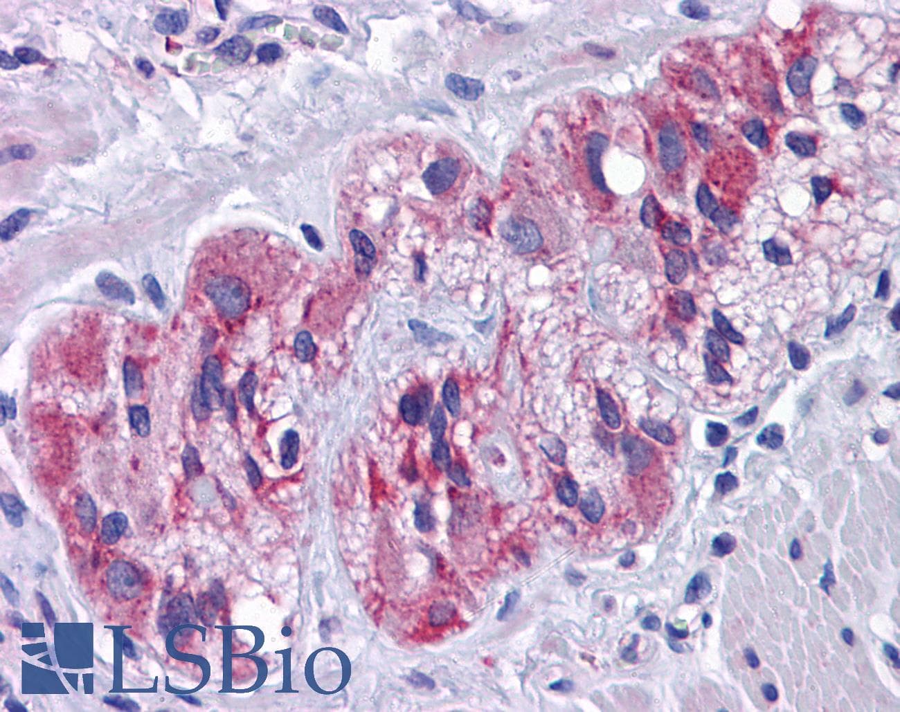 IHC-plus™ Polyclonal Rabbit anti-Human SLC39A7 / ZIP7 Antibody (IHC, IF, WB)