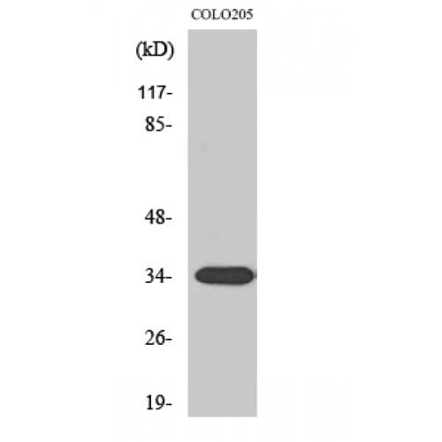 Polyclonal Rabbit anti-Human CNN2 Antibody (90-170 aa, Internal, IF, WB)