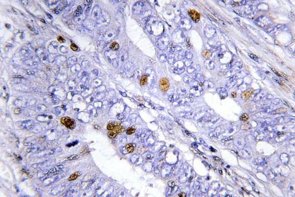 NR4A1 / NUR77 Antibody (Gly347)