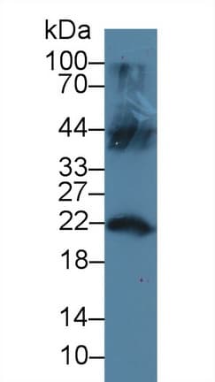 LCN12 Antibody (aa61-184)