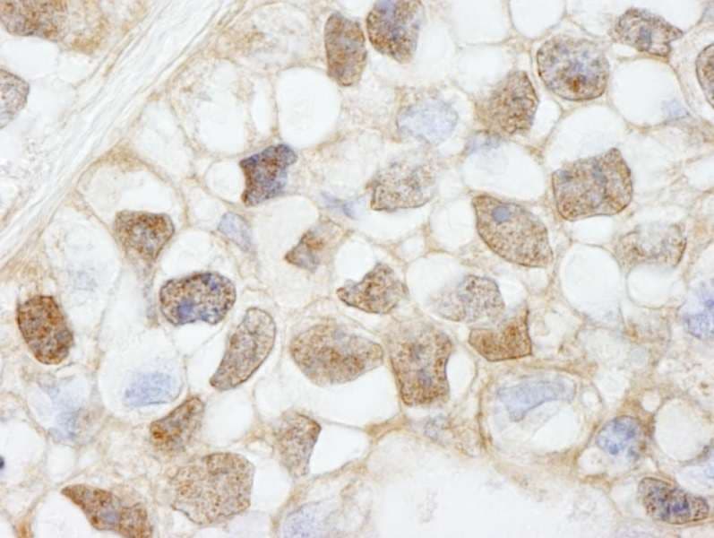 HDAC7 Antibody (aa902-952)