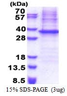 Human NIPSNAP1 Protein (Recombinant His)