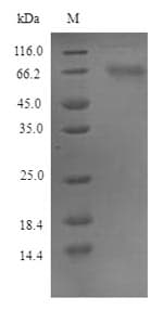 Mouse FAM83D Protein (Recombinant 6His, N-terminus)