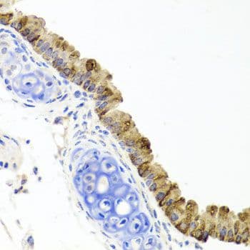 TOPBP1 Antibody