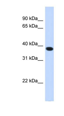 ACBD4 Antibody (N-Terminus)