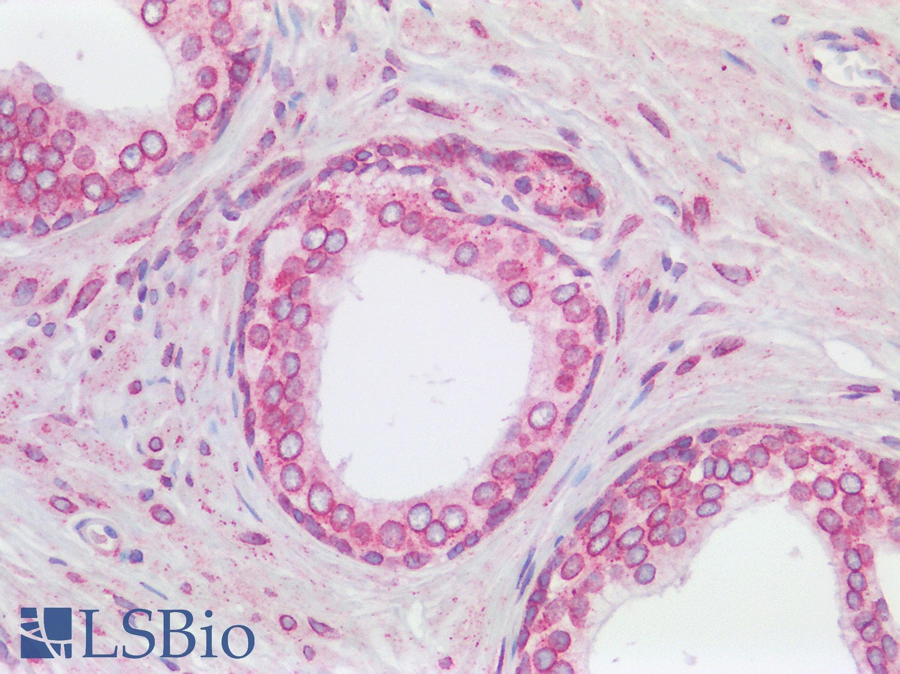 IHC-plus™ Polyclonal Rabbit anti-Human RANGAP1 Antibody (aa400-450, IHC)