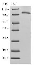 Human SERPINB9 / PI9 Protein (Recombinant GST, N-terminus)