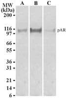 AR / Androgen Receptor Antibody (phospho-Ser213, clone 156C135.2)