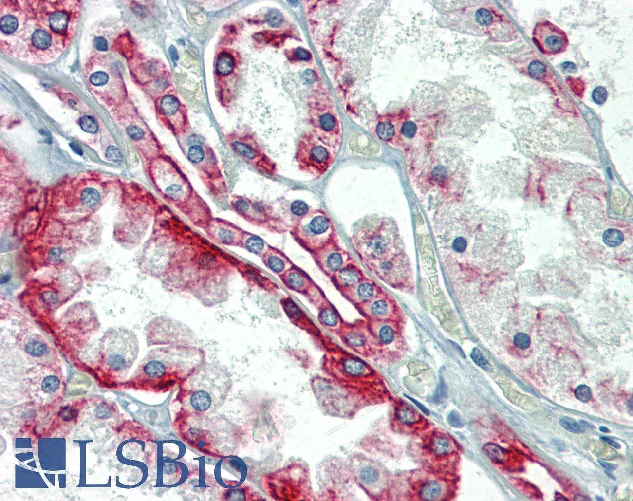PathPlus™ KRT18 / CK18 / Cytokeratin 18 Antibody (clone C-04)