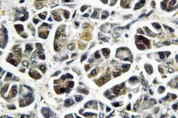 NDUFA8 Antibody (Pro141)