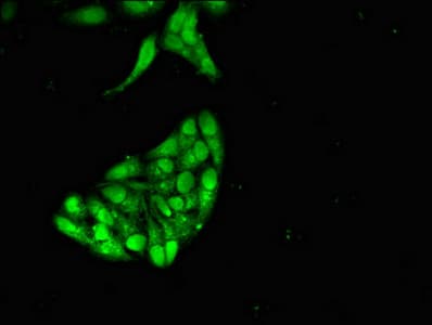Polyclonal Rabbit anti-Human KDM4D / JMJD2D Antibody (IHC, IF)