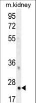 Polyclonal Rabbit anti-Human HOXB6 Antibody (aa128-155, IHC, WB)
