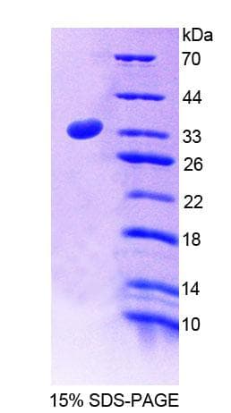 Rat ADGRL2 / LPHN2 Protein (Recombinant His-T7)