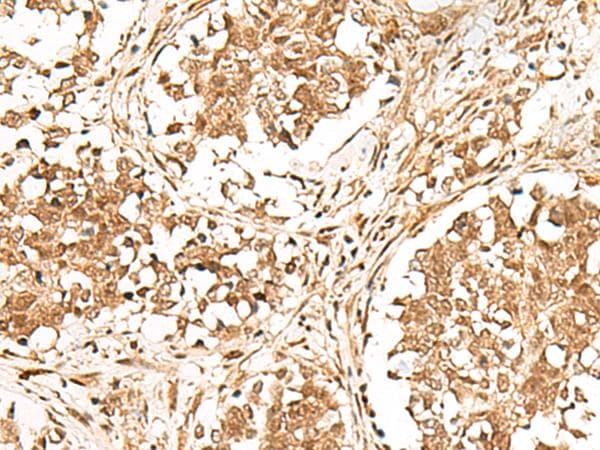 Polyclonal Rabbit anti-Human GMEB2 Antibody (IHC)