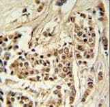 Polyclonal Rabbit anti-Human TTPAL / C20orf121 Antibody (aa204-233, IHC, WB)