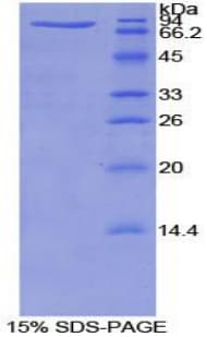Mouse SERPINA10 / PZI Protein (Recombinant His-GST)