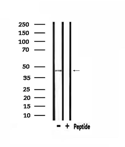 NMUR1 Antibody