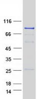 Human RAD54L Protein (Recombinant Myc-DDK (Flag))