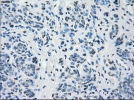 BUB1B / BubR1 Antibody (clone OTI10E7)