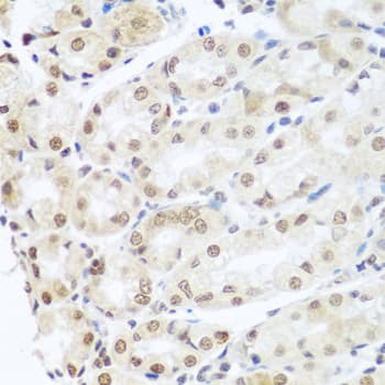 SNAI1 / SNAIL-1 Antibody