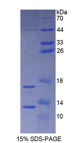 Rat SNCA / Alpha-Synuclein Protein (Recombinant His)