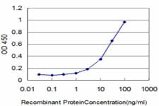 CRD / CRX Antibody (clone F6-C2)
