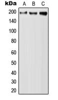 Polyclonal Rabbit anti-Human QSER1 Antibody (Internal, WB)