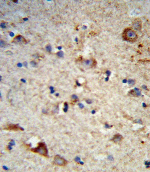 EXT2 Antibody (aa182-209)