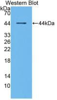 TNFRSF11A / RANK Antibody