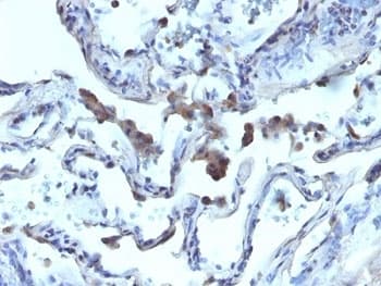 Polyclonal Rabbit anti-Human AMACR / P504S Antibody (IHC)