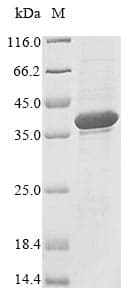 Human RNASEH1 Protein (Recombinant 6His, N-terminus)