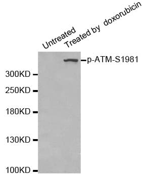 ATM Antibody (phospho-Ser1981)