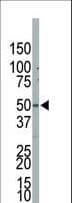 PIP4K2B Antibody (aa286-317)