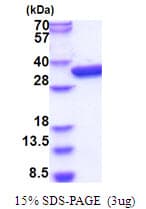 E. coli glk / Glucokinase Protein (Recombinant His)