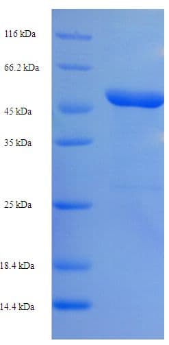 Rat SERPINE1 / PAI-1 Protein (Recombinant His-SUMO)