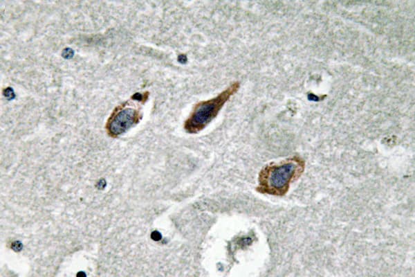 ANXA2 / Annexin A2 Antibody (Asn137)