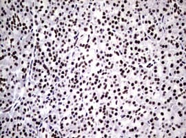 NBN / Nibrin Antibody (clone OTI6H7)