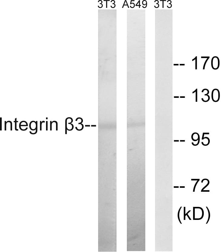 IHC-plus™ ITGB3 / Integrin Beta 3 / CD61 Antibody (aa739-788)