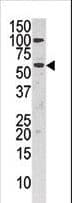 Polyclonal Rabbit anti-Human CHKA / CK / Choline Kinase Antibody (aa427-457, WB)