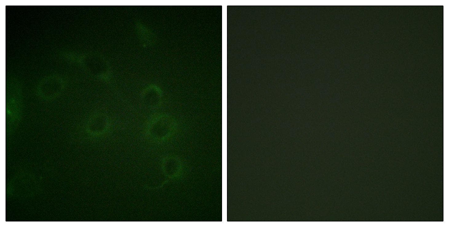 CD45 / LCA Antibody