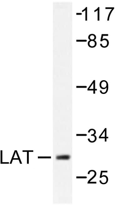 Polyclonal Rabbit anti-Human LAT Antibody (Leu185, WB)