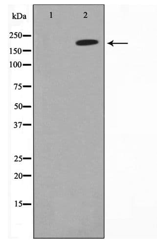 COL5A1 / Collagen V Alpha 1 Antibody