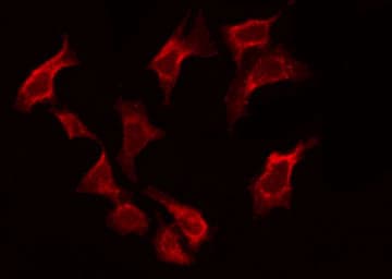 BAF53 / ACTL6A Antibody