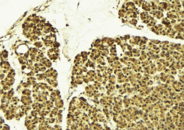 EAR2 / NR2F6 Antibody