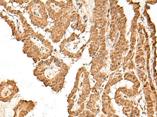 CCDC132 Antibody